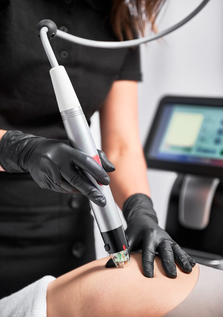 Plantar Fasciitis Treatment Camrose 6 Shockwave and Laser Therapy Camrose with shockwave treatment applied to the knee to support pain relief, tissue healing, and improved joint function.